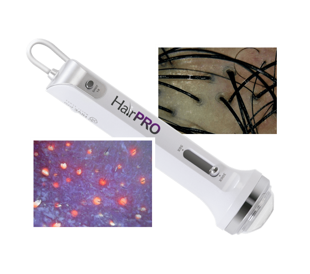 ImagePro® HairPRO, a precision scalp & hair analysis device that drives your practice forward