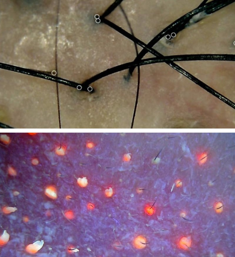 Detailed image of a scalp from Hair Restoration and Scalp Analysis Tool